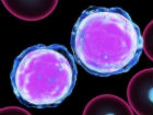 Leucemia